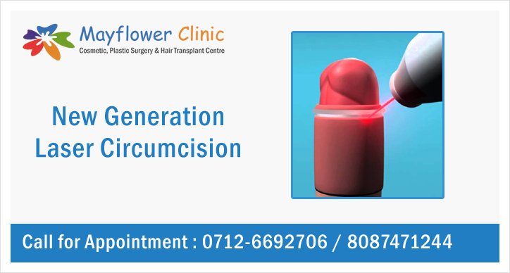 Laser Circumcision Surgery Nagpur