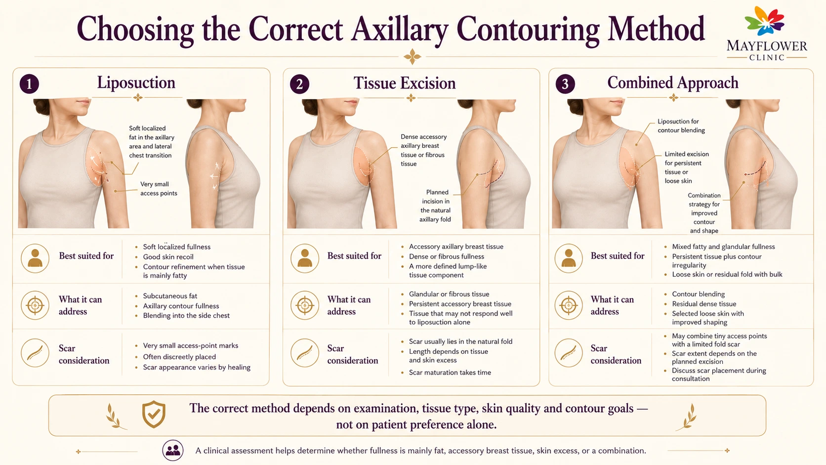 Comparison of liposuction, accessory tissue excision and combined axillary contouring approaches