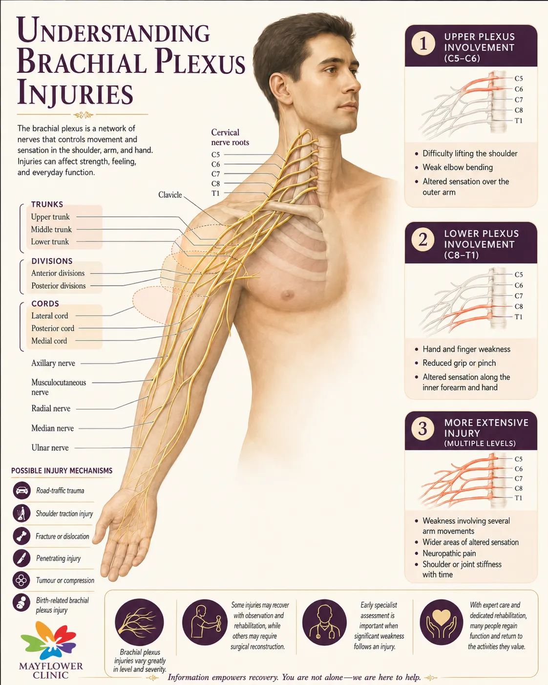 Brachial plexus anatomy from C5 to T1 with upper and lower plexus injury patterns
