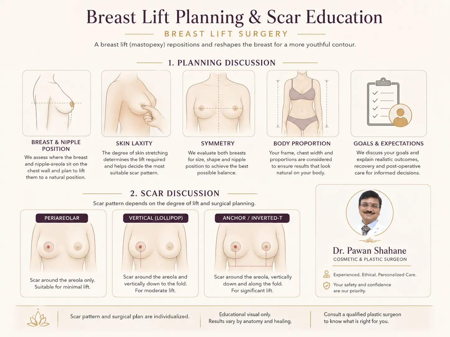 Breast lift planning and scar education graphic showing nipple position, skin-envelope reduction and common mastopexy scar patterns