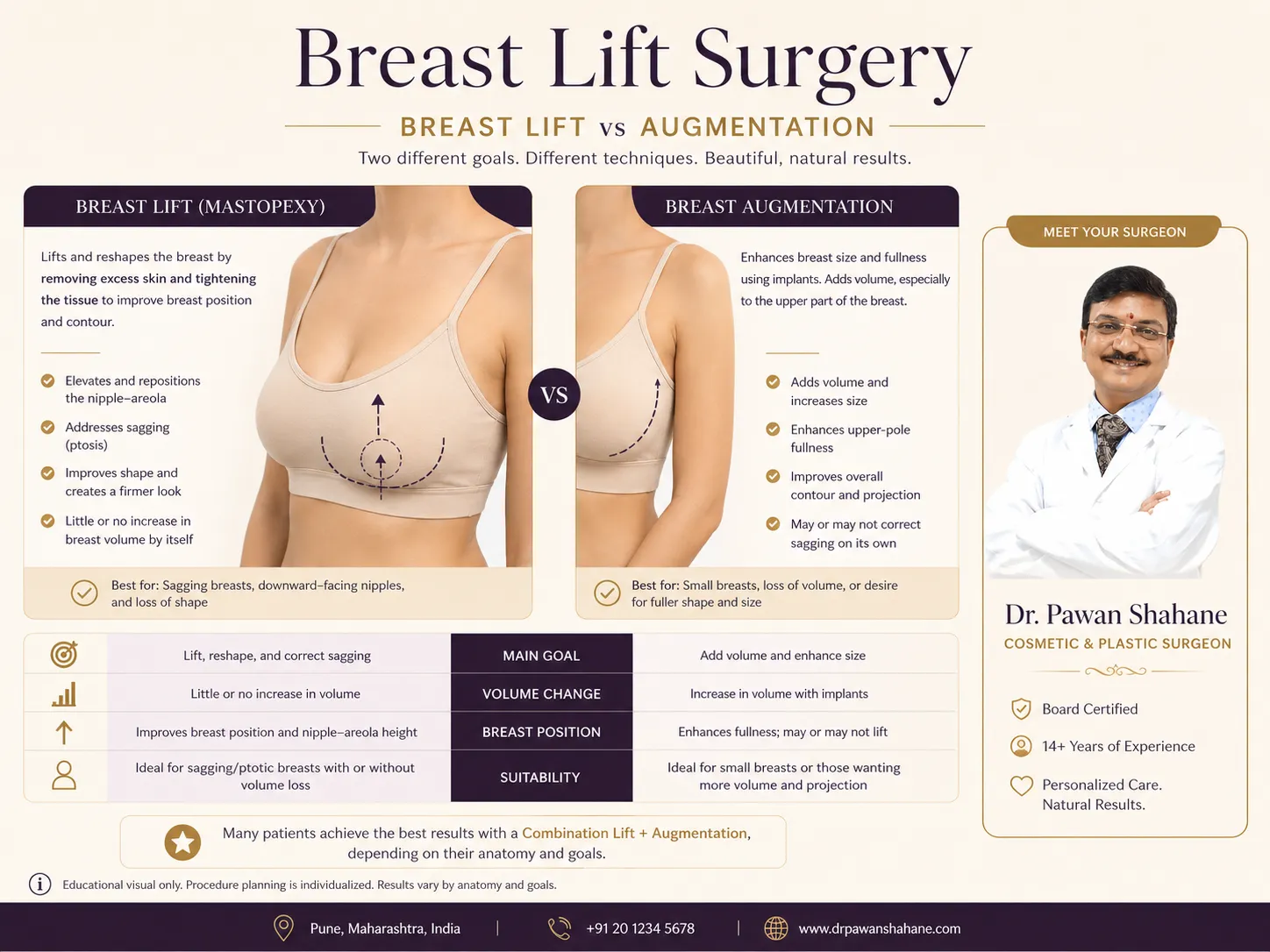 Breast lift versus breast augmentation difference diagram explaining position and volume goals
