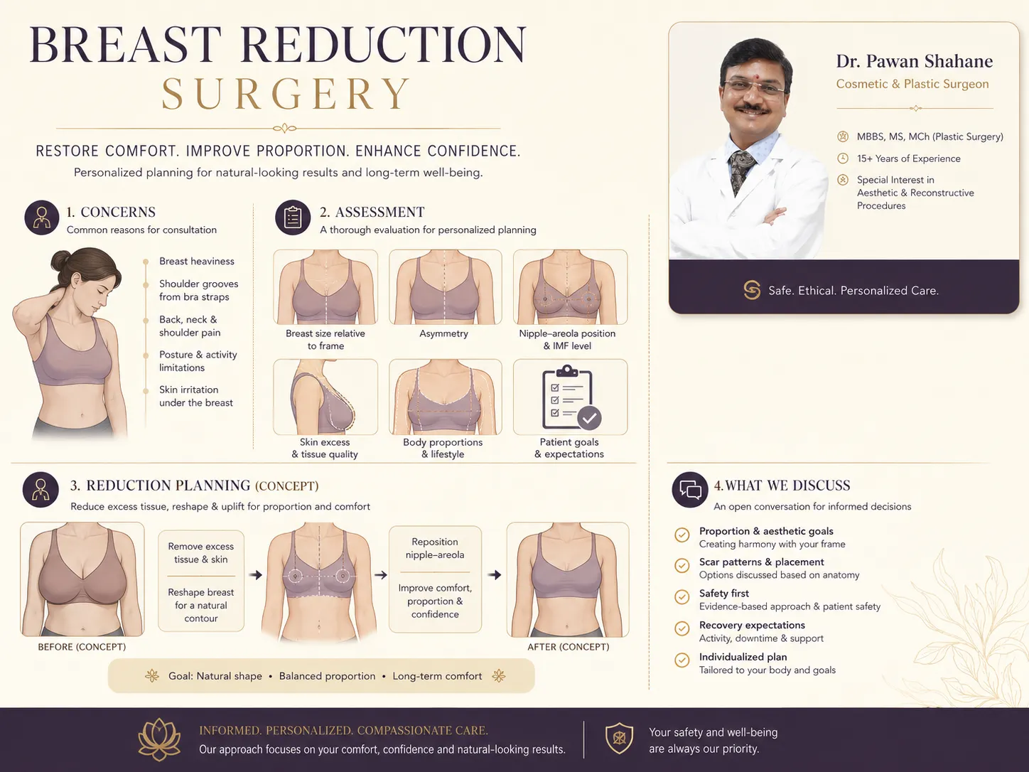 Non-graphic breast reduction planning concept showing tissue reduction, skin-envelope reduction and nipple repositioning