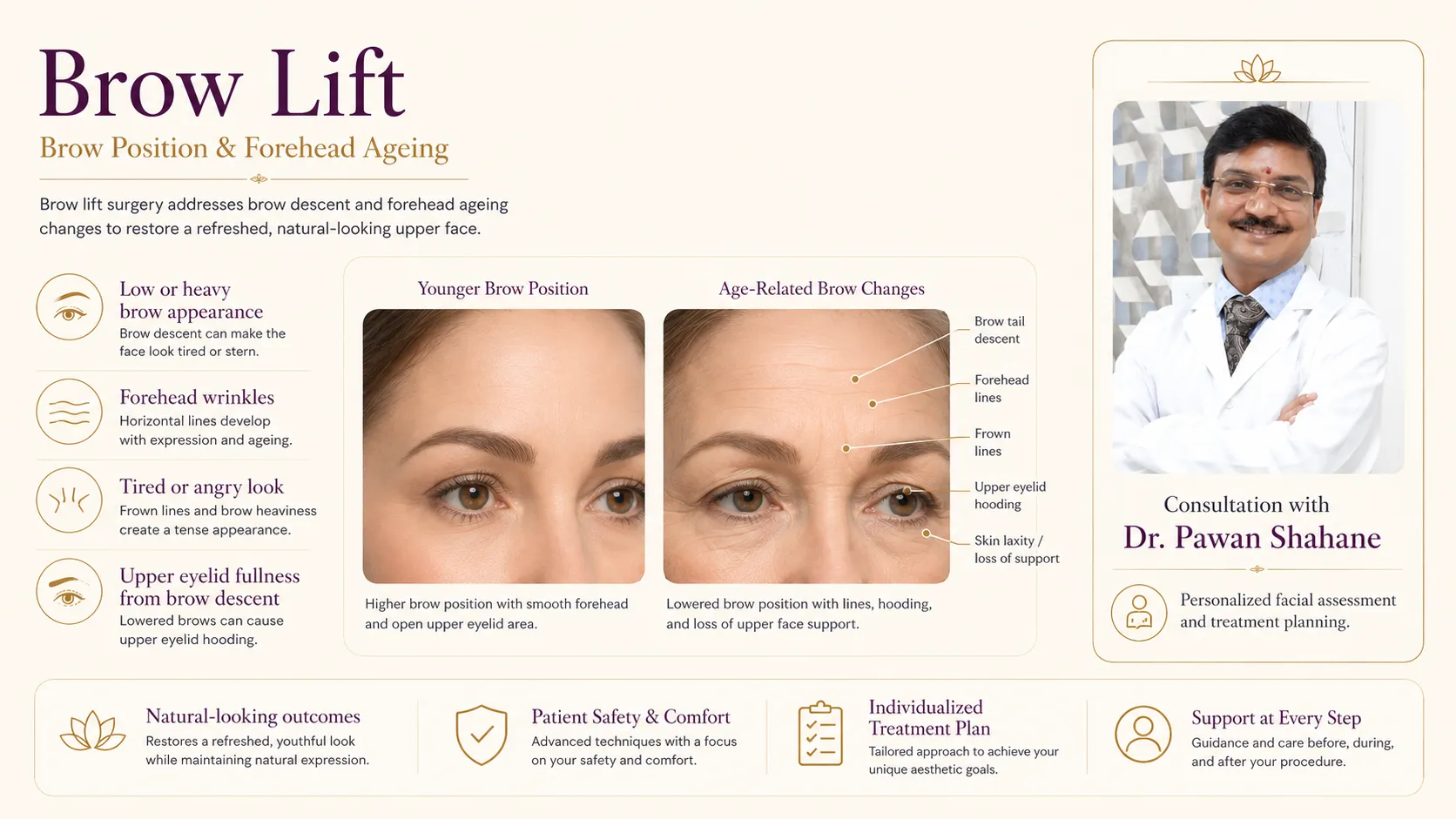 Brow position and forehead ageing diagram showing eyebrow descent and upper eyelid hooding
