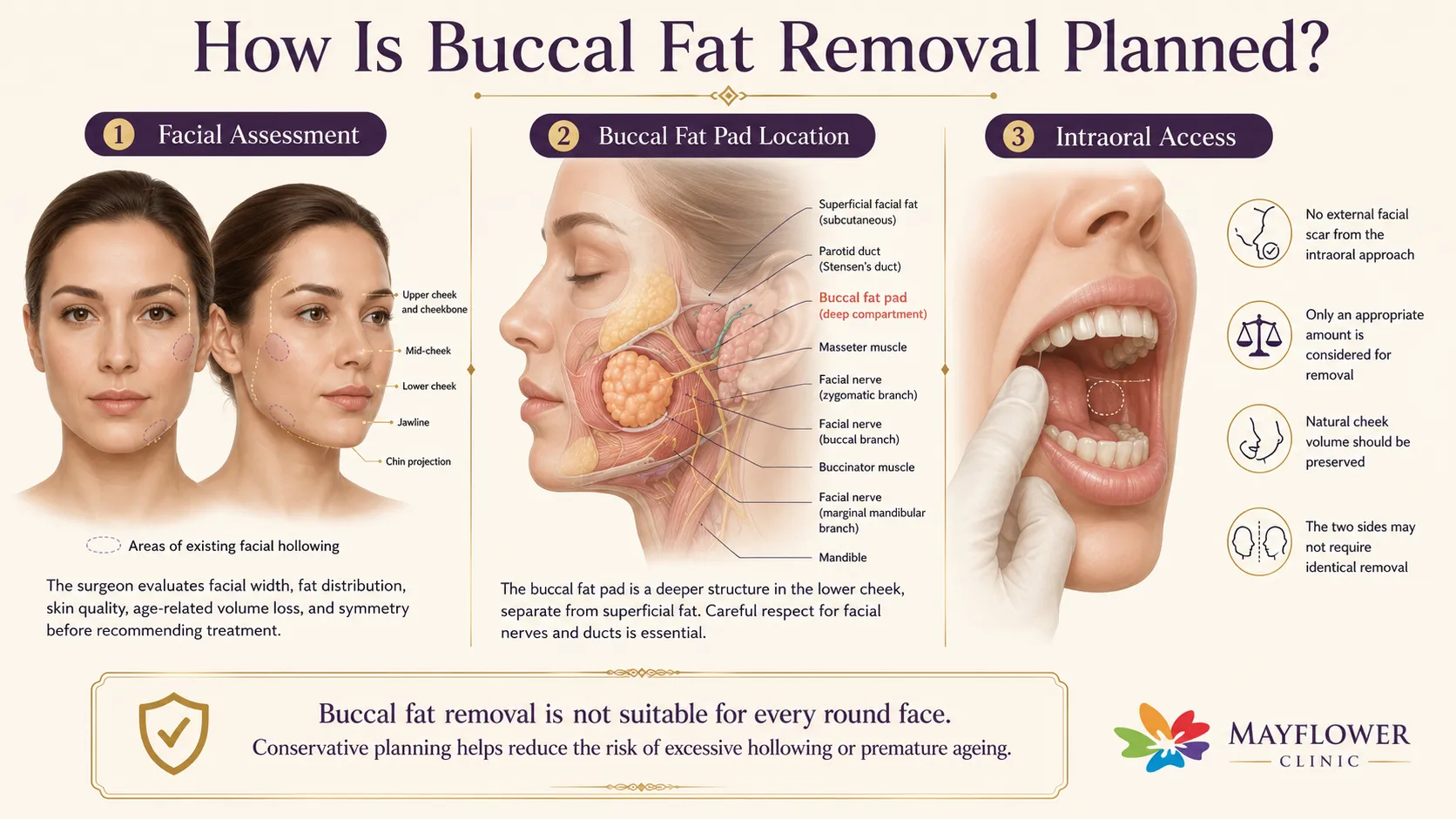 Educational diagram showing buccal fat pad location, facial assessment, intraoral access and nearby structures considered during surgery