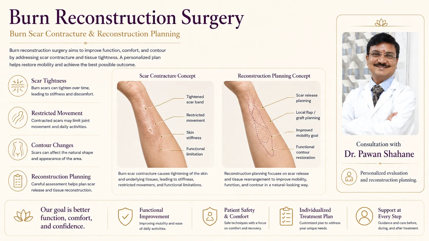 Burn scar contracture and reconstruction planning infographic showing tightness, restricted movement, scar release, local flap or graft planning