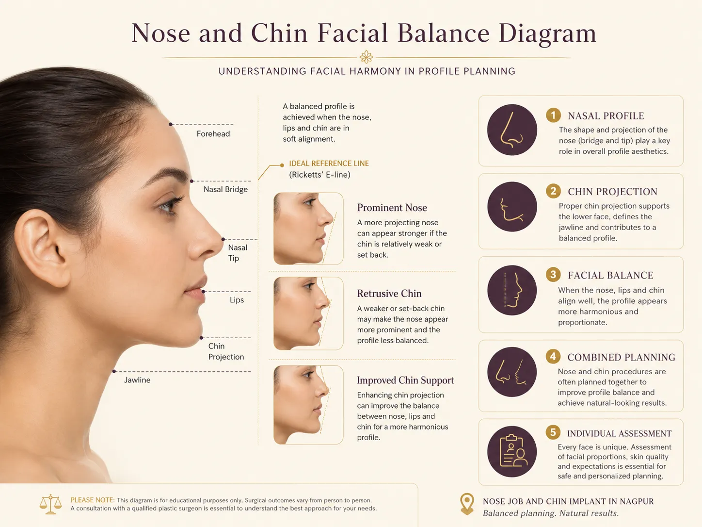 Nose and chin facial balance profile diagram