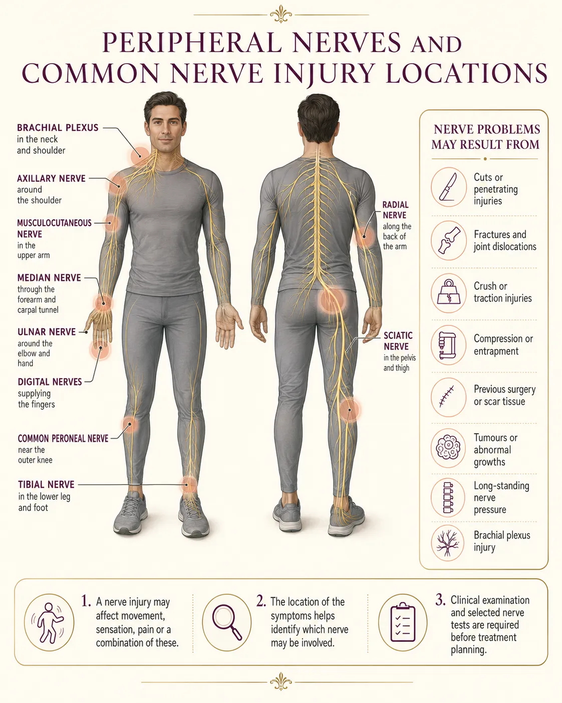 Peripheral nerve anatomy map showing major nerves of the upper and lower limbs