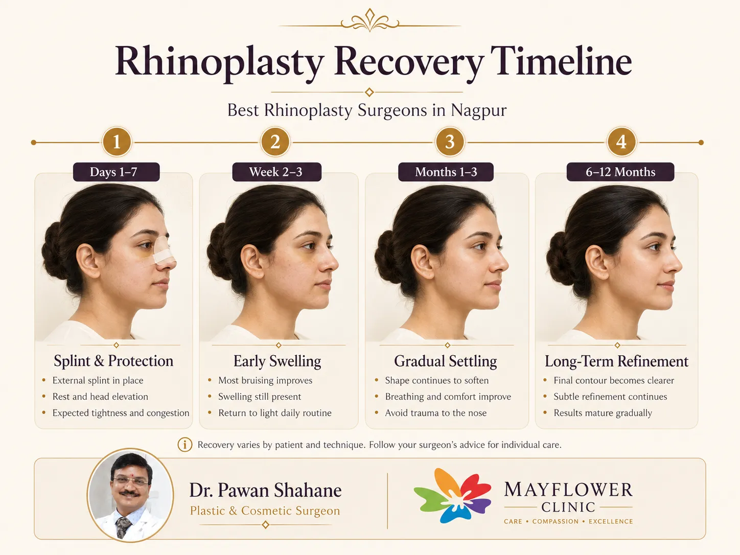 Rhinoplasty recovery timeline showing splint, swelling and long-term refinement
