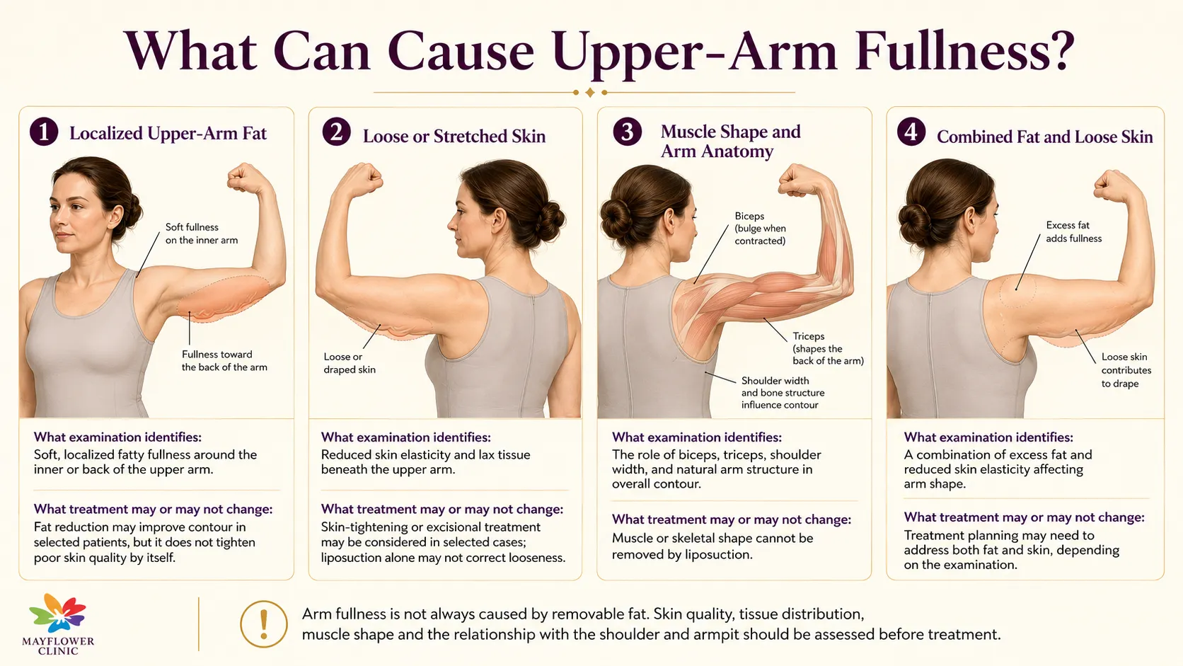 Medical infographic explaining localized upper-arm fat, loose skin, muscle shape and combined causes of upper-arm fullness