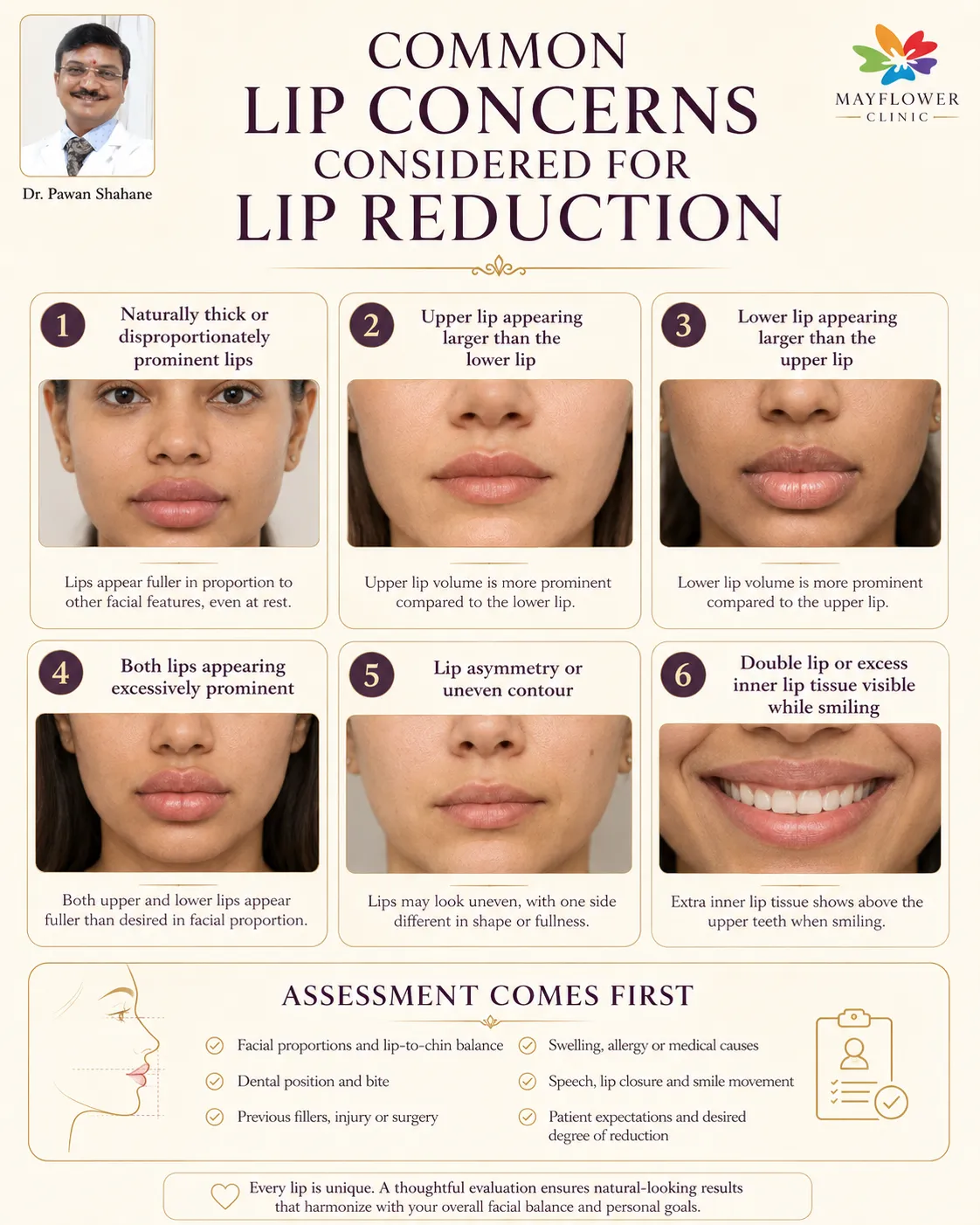 Common lip concerns assessed before lip reduction surgery, including prominent lips, asymmetry, double lip and imbalance between the upper and lower lips