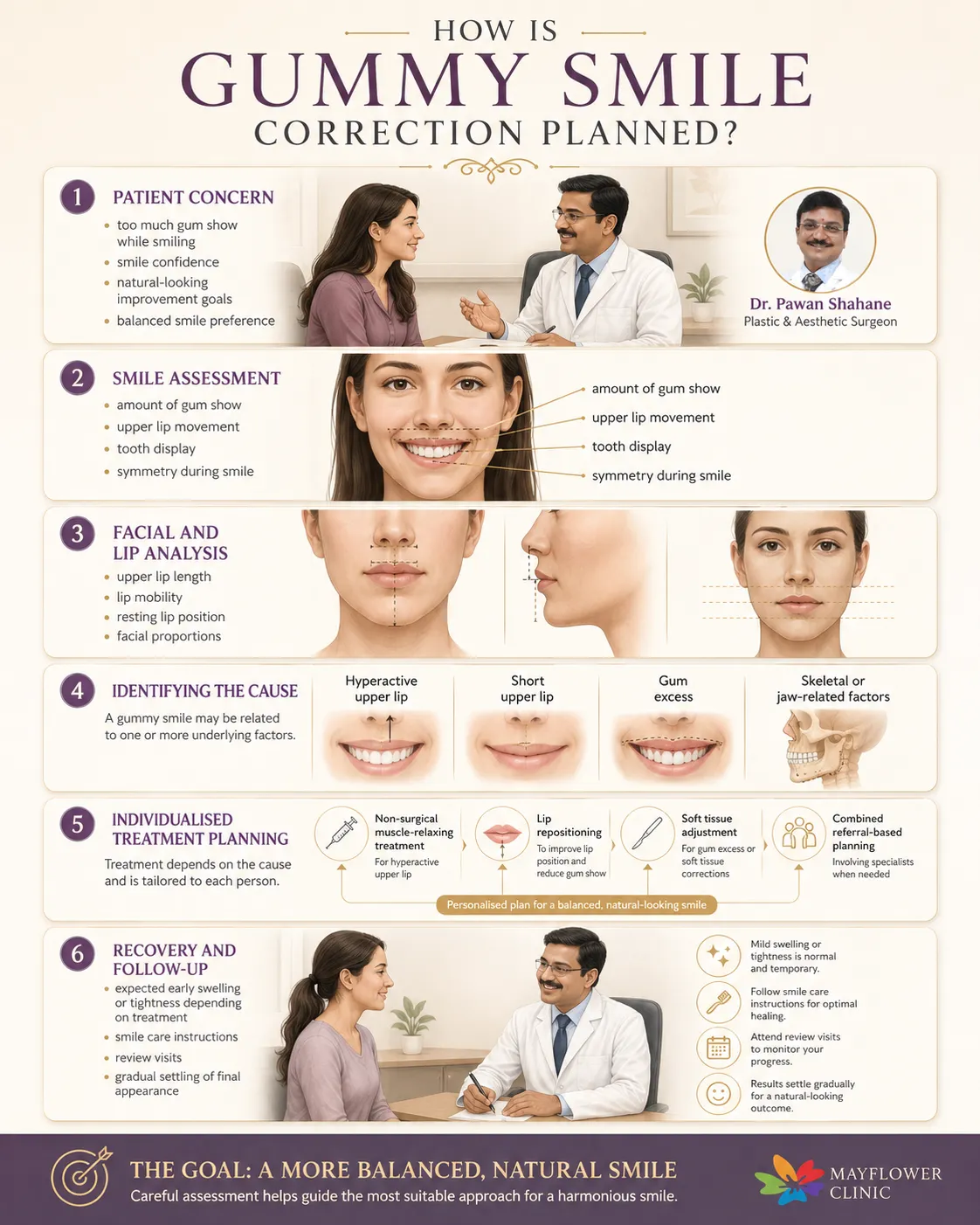 How gummy smile correction is planned through consultation, smile assessment and cause-based treatment selection